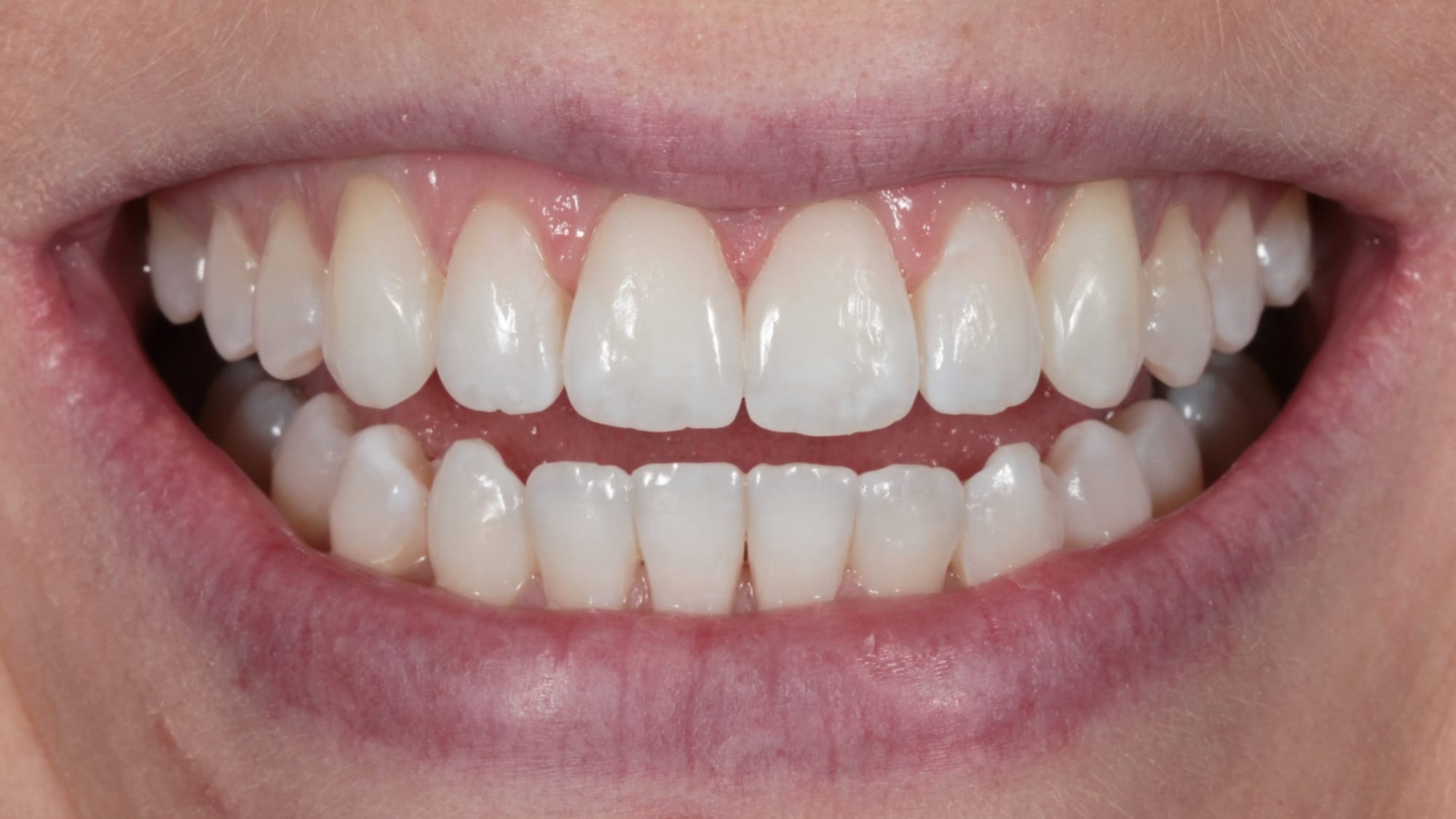 After — Rotations and uneven edges