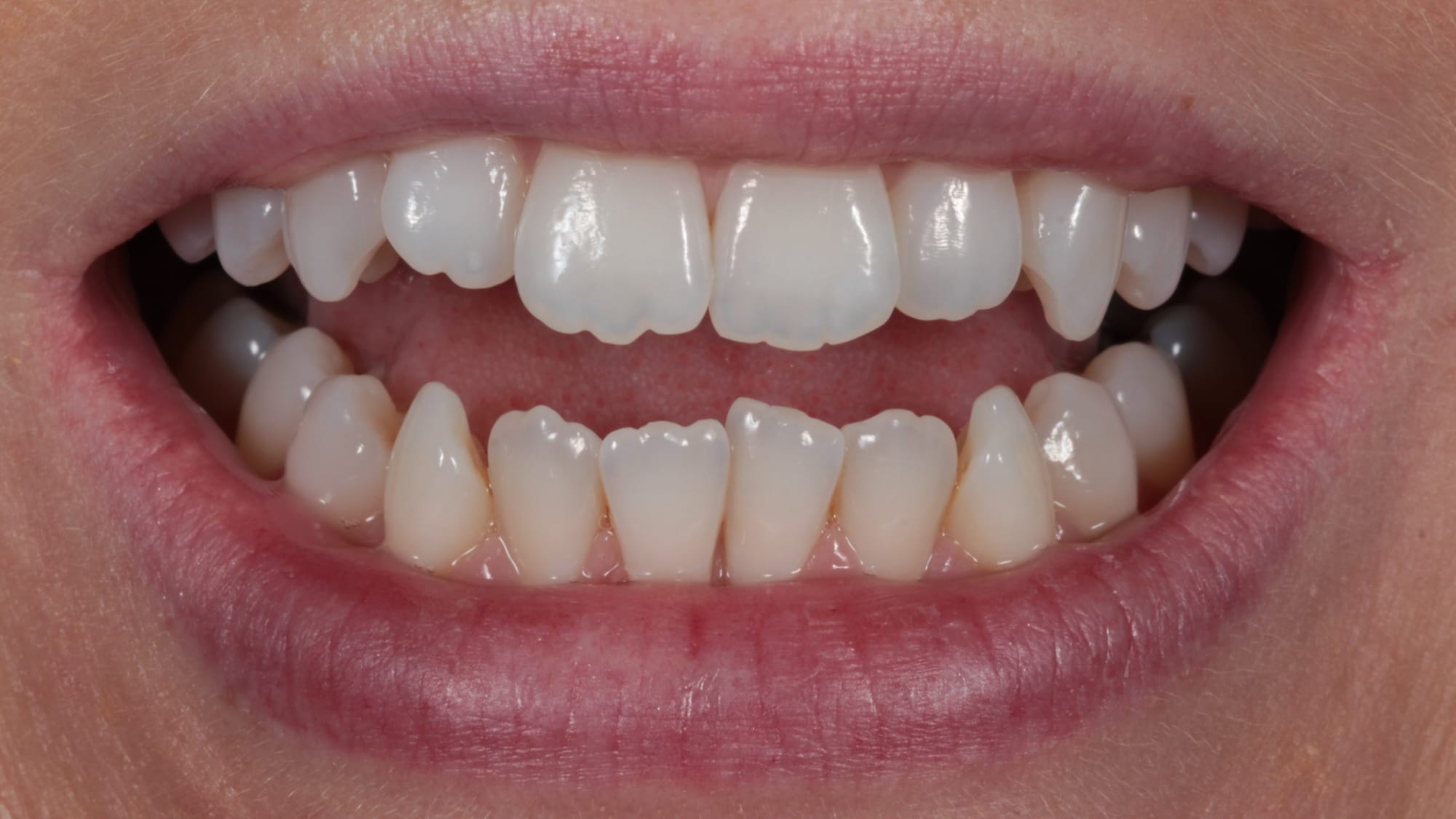 Before — Rotations and uneven edges