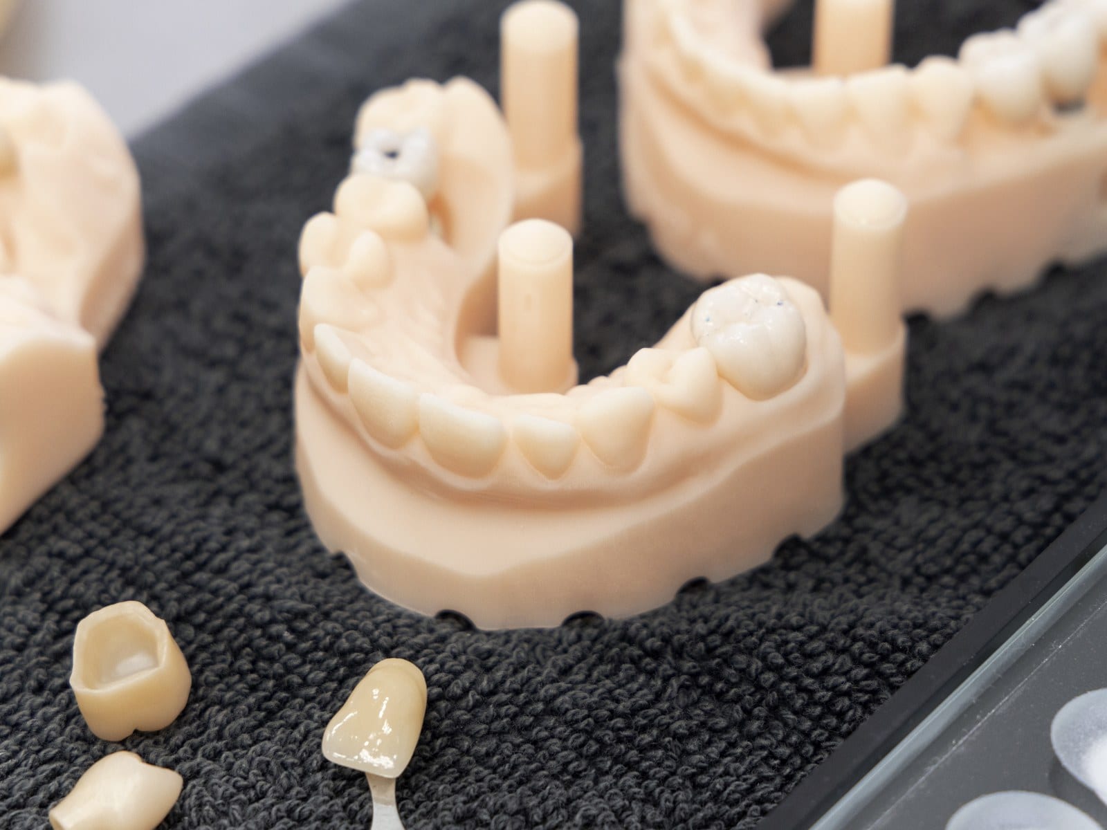 Porcelain firing in the dental kiln